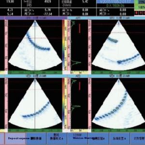 Oem Aanpasbare Ultrasone Foutdetector Multifunctionele Tofd Phased Array Voor Lasinspectie Van Metalen Pe-Materialen - Product Image 4