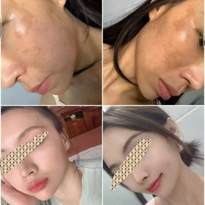 Tratamiento Instantáneo para Melasma y Hiperpigmentación, Peeling Anti-Melasma, Cuidado de la Piel, Set de 4 Piezas - Product Image 4