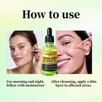 Sérum Visage OEM ODM à l'Acide Azélaïque et Hamamélis, Traitement Anti-Acné, Affinant les Pores, Contrôle du Sébum, Réparation de la Barrière Cutanée, Apaisant, Usage Domestique