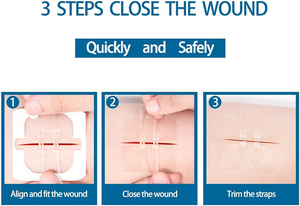 Tiras Adhesivas Estériles para Cierre de Heridas YOJO PU, Impermeables, para Incisiones Quirúrgicas, Laceraciones y Cuidado de Heridas - Product Image 3