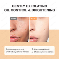 Nettoyant Visage Anti-Acné Herbal SKINEVER de Haute Qualité Coréen à l'Acide Salicylique pour Femme