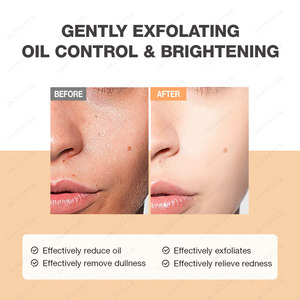 Nettoyant Visage Anti-Acné Herbal SKINEVER de Haute Qualité Coréen à l'Acide <span class=keywords><strong>Salicylique</strong></span> pour Femme - Product Image 5