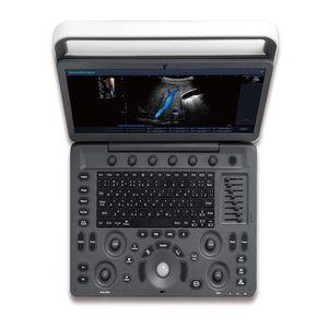 Appareil d'échographie portable Doppler couleur SonoScape E2V avec un transducteur pour clinique vétérinaire et hôpital - Product Image 6