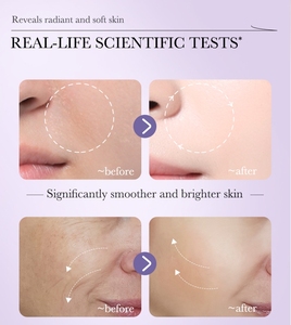 Esencia Facial <span class=keywords><strong>de</strong></span> Nicotinamida y Retinol, Iluminadora y Mejoradora para la Piel Seca por <span class=keywords><strong>Noche</strong></span>, Cuidado Facial, Precio al por Mayor - Product Image 2