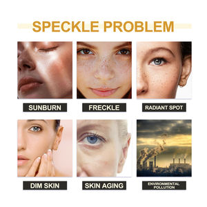 Jaysuing crème éclaircissante speckile chloasma enlever hydratant meilleure qualité blanchissant anti-taches crème - Product Image 4