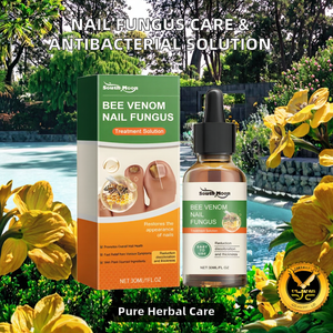 Solución Herbal para el Cuidado <span class=keywords><strong>de</strong></span> <span class=keywords><strong>Hongos</strong></span> en las <span class=keywords><strong>Uñas</strong></span> <span class=keywords><strong>de</strong></span> 30 ml, Venta Caliente, Marca Privada Personalizada, para <span class=keywords><strong>Uñas</strong></span> Suaves y Gruesas, Antibacteriana, Vida Útil <span class=keywords><strong>de</strong></span> 3 Años - Product Image 2