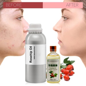 Olio di valeriana <span class=keywords><strong>naturale</strong></span>/olio di valeriana sfuso/olio di radice di valeriana diffusore olio essenziale olio profumato per candela - Product Image 4