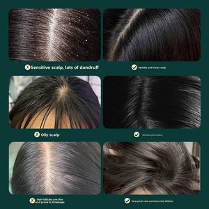 Masajeador de Cabeza y Cuero Cabelludo Recargable CYANMED con <span class=keywords><strong>EMS</strong></span>, Alivio del Estrés, Lavado de Cabello, Garra de Silicona, Terapia de Luz Roja LED y Control por Botones - Product Image 2