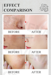 Công thức tùy chỉnh nhau thai viên nang Mặt huyết thanh cho tất cả các loại da - Product Image 3