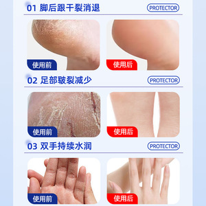 Crema para las Quemaduras de Frío Zhuochen, Crema Anti-Picazón y para Piel Seca y Agrietada, Producto Original, Previene las Quemaduras de Frío en Niños, Manos y - Product Image 3