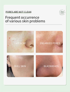 Maschera di <span class=keywords><strong>Argilla</strong></span> <span class=keywords><strong>Naturale</strong></span> alla Artemisia <span class=keywords><strong>per</strong></span> Tutti i Tipi di Pelle, Riduce l'Acne, i Punti Neri, Pulisce i Pori e Controlla <span class=keywords><strong>il</strong></span> Sebo - Product Image 6