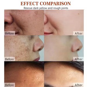 Nicotinamide Acide Hyaluronique Correcteur de Taches Noires Vitamine E Crème Éclaircissante Jour Nuit Tous Types de Peau Marque Privée OEM/ODM - Product Image 3