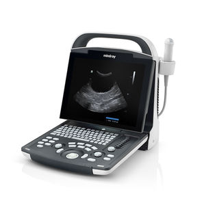 Ecógrafo Mindray DP-10, Potente Escáner en Blanco y Negro, Certificado CE, Equipo de Diagnóstico Médico Clase II - Product Image 1