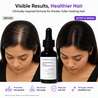 Sérum de densification capillaire ETRUN ALISA Private Label 18% - Sérum stimulant la croissance des cheveux pour le contrôle de la chute des cheveux chez les femmes et les hommes - Prévient la perte de cheveux