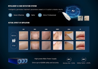 Appareil d'épilation laser multi-tailles avec détection des poils par IA et système de contrôle à distance, adapté à tous les types de peau et de cheveux