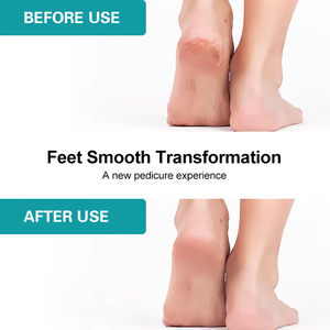 Vente en gros de produits de pédicure professionnels en acier inoxydable de haute qualité pour enlever les callosités lime à pied pierre ponce soins des pieds efficaces - Product Image 4