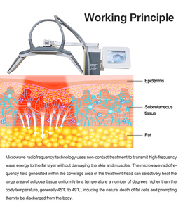 เครื่องกำจัดไขมันรุ่นล่าสุดปี 2026 เครื่องสลายไขมันขาใหญ่ ลดเซลลูไลท์ - Product Image 5