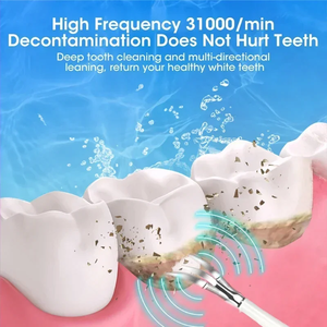 Cepillo de dientes eléctrico con limpieza sónica 3 en 1 para eliminar el sarro, blanquear los dientes, cuidado bucal, carga USB, reemplazo del cabezal del cepillo - Product Image 4