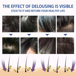 <span class=keywords><strong>Spray</strong></span> para Eliminar Piojos con Ingredientes Herbales Naturales de Resultados Visibles - 30 ml, <span class=keywords><strong>Spray</strong></span> para Eliminar Piojos y <span class=keywords><strong>Pulgas</strong></span> para el Cuidado Diario del Cabello - Product Image 6