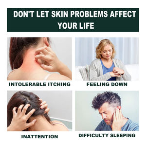 Krim Herbal Alami South Moon 20g untuk Psoriasis Eksim, Krim Anti Gatal untuk Kulit Kaki, Tangan, dan Tubuh, Krim Pereda Psoriasis dan Eksim - Product Image 6