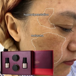 Tratamiento Instantáneo para Melasma y Hiperpigmentación, Peeling Anti-Melasma, Cuidado de la Piel, Set de 4 Piezas - Product Image 1