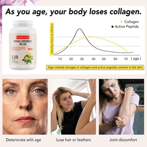 <span class=keywords><strong>Comprimés</strong></span> d'<span class=keywords><strong>acide</strong></span> <span class=keywords><strong>hyaluronique</strong></span> OEM personnalisés pour la santé articulaire hydratation de la peau et complément alimentaire - Product Image 2