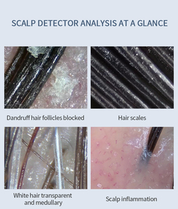 Mestek — <span class=keywords><strong>Mini</strong></span>-mètre numérique pour l'humidité de la peau, analyseur Digital rapide, de numérotation, prix de Machine, Portable - Product Image 4
