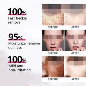 Crème <span class=keywords><strong>Visage</strong></span> Éclaircissante Anti-Taches pour Atténuer la Texture de la Peau Taches Jaunes Brunes Taches de Rousseur Éclaircir le Teint Cosmétiques Usine - Product Image 3