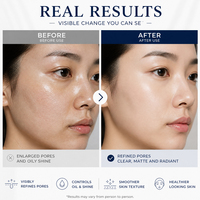 Ensemble de soins de la peau OEM/ODM, sérum ampoule à 5% de nicotinamide, soin à la vitamine C B3, blanchissant, anti-âge, anti-rides, hydratant pour le visage