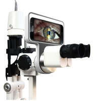 Sistema de Imagenología para Lámpara de Hendidura de Gran Venta Compatible con Android y iPhone