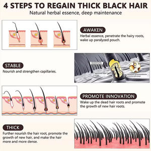 Champú y Acondicionador Personalizados para el Crecimiento del Cabello con Bloqueador de DHT, con Logotipo, Champú <span class=keywords><strong>Natural</strong></span> <span class=keywords><strong>Sin</strong></span> Sulfatos Anticaída, Venta al por Mayor - Product Image 5