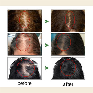 Olio per Capelli al Rosmarino con Estratto di Erbe Pure, Nutre i Capelli Secchi, Ripara le Doppie Punte, Calma il Cuoio Capelluto Sensibile - Product Image 5