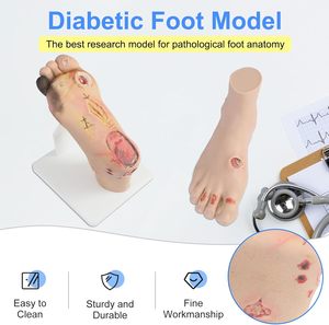 Modelo de pie diabético (leve/severo) para formación médica, maniquí preventivo para el pie diabético, silicona CE/ISO - Product Image 4