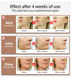 Productos de tendencia 2025 Nuevas llegadas Máquina de estiramiento facial de microcorriente USB Masajeador de estiramiento de cuello Dispositivo de cinturón de elevación de cara en V - Product Image 4