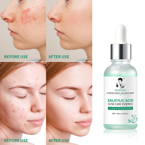 Suero Anti-Acné con Logo Personalizado, a Base de Plantas Naturales, con Hamamelis y Aloe, Nutritivo, Reparador, Aclara las Marcas de Acné, Elimina el Acné, Marca Privada - Product Image 2