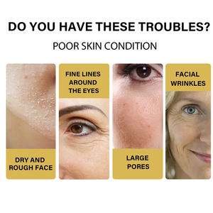 Collageen Draad Instant Lifting Anti-Aging Hydraterende Vloeibare Oplosbare Proteïne Serum Rimpelverwijderaar Gezichtsvuller Verstevigend - Product Image 4