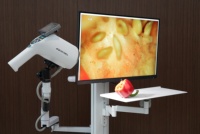 Colposcope vidéo numérique HD Kernel GN-500, système d'imagerie multi-modes pour le dépistage du cancer du col de l'utérus et l'examen gynécologique