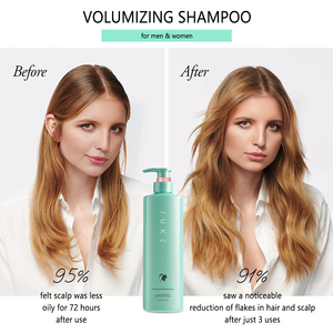 <span class=keywords><strong>Champú</strong></span> <span class=keywords><strong>y</strong></span> Acondicionador Vegano de Karité al por Mayor de Fábrica, Limpiador Capilar Calmante <span class=keywords><strong>y</strong></span> Refrescante para Cuero Cabelludo <span class=keywords><strong>Graso</strong></span> e Irritado - Product Image 3