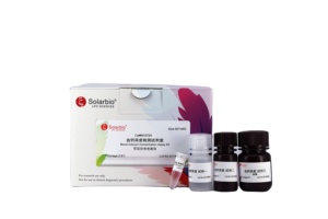 Solarbio Chất lượng cao trực tiếp bilirubin (dibl) nội dung khảo nghiệm Kit cho nghiên cứu khoa học - Product Image 5
