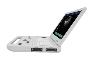 Appareil d'échographie portable avec écran LCD de 15 pouces, scanner de diagnostic vétérinaire avec SSD de 128 Go, système d'<span class=keywords><strong>imagerie</strong></span> clinique de 4,8 kg - Product Image 5
