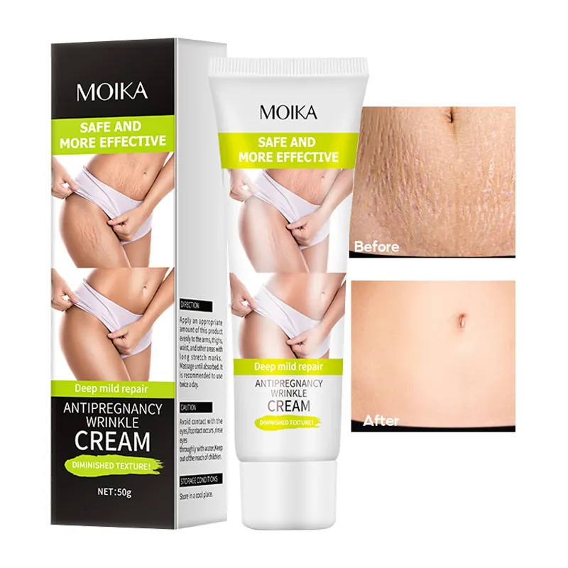 Wholesale Acne Pimples Stretch Marks Scar Removing Cream Face And Legs Old Scars Body Scar Removal Cream