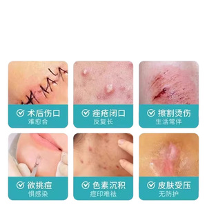 Apósitos Hidrocoloides Win/Health Medical, Apósitos Húmedos para Abrasiones, Heridas Postoperatorias, Úlceras por Presión y Uso Médico - Product Image 2