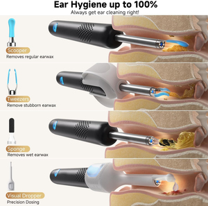 Limpiador de Oídos Visual Inalámbrico Inteligente, Recargable Tipo-C, Herramienta Eléctrica para Remover Cera con Endoscopio, 6 Luces LED, Cámara HD - Product Image 2