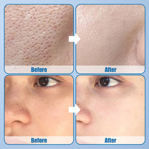 Nhãn Hiệu Riêng Hữu Cơ Mỹ Phẩm Chăm Sóc Da Giữ Ẩm Nhẹ Nhàng Nuôi Dưỡng Cải thiện Cồng kềnh Lỗ Chân Lông Người Đàn Ông Của Khuôn Mặt Mực Cho Tất Cả Các Da - Product Image 4