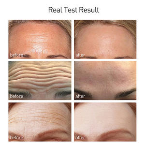 Parche para Arrugas en la Frente de Marca Privada 5g con Vitamina E y Ácido Hialurónico, Blanqueador y Nutritivo, OEM ODM - Product Image 5