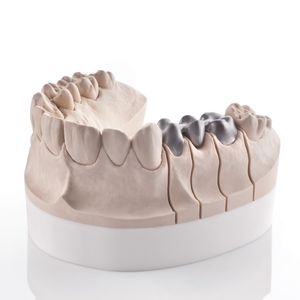 Riston D-120 slm laser 3d imprimante métal 3d dentier imprimante industrielle métal - Product Image 5