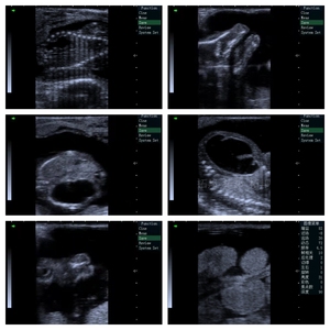 Tierarzt Ultraschall Handheld Veterinär diagnostik Ultraschall farm Verwendung Equine Ultraschall gerät Preis Pferd Schwangerschaft scanner - Product Image 4