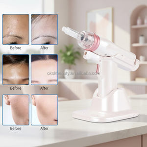 Pistolet à eau portable à pression négative, style tendance, instrument d'hydrothérapie à prix réduit pour usage domestique - Product Image 2