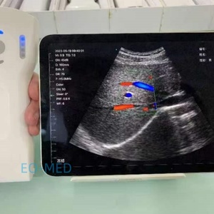 Échographe portable sans fil à double sonde Doppler, 64 canaux, 192 éléments, 3 en 1, pour usage vétérinaire DCU19H - Product Image 5