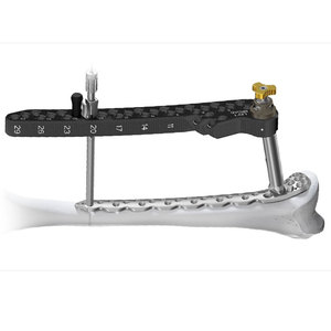Ensemble d'instruments manuels de haute précision pour traumatologie, chirurgie générale orthopédique, kit d'instruments médicaux réutilisables en acier inoxydable - Product Image 1
